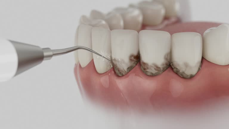 Reliable Dental contractor in Morristown, TN by Dentist Open Now